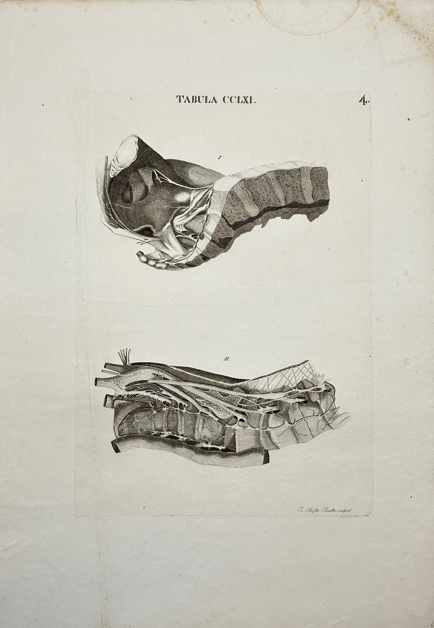 Original Antique Print - Antonio Caldani - Anatomy of the Pelvis - F4