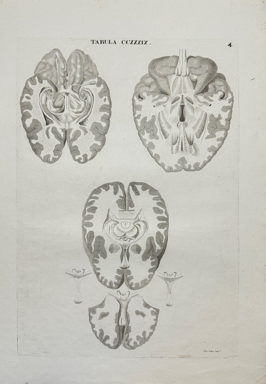 Anatomy Antique Print - Antonio Caldani - View From Inside the Skull - F4